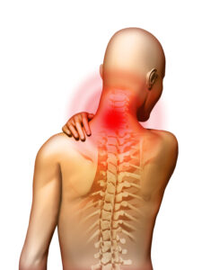 Spondylitis